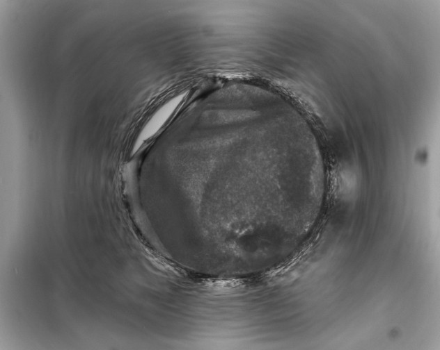 X0000098170517200805081004