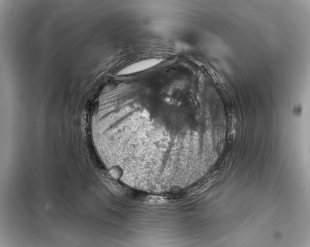 X0000098170519200805081004