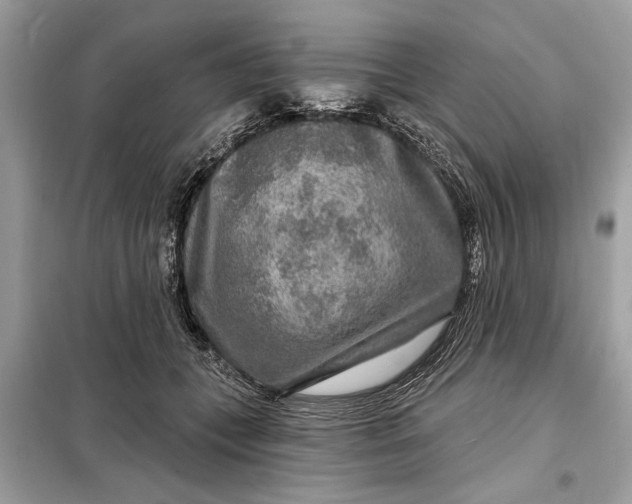 X0000098170559200805081003