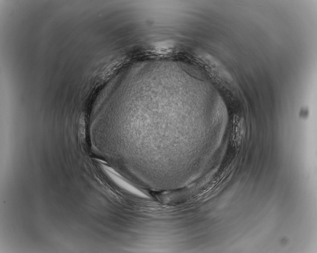 X0000098170562200805081003