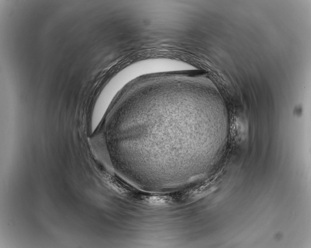 X0000098170566200805081003