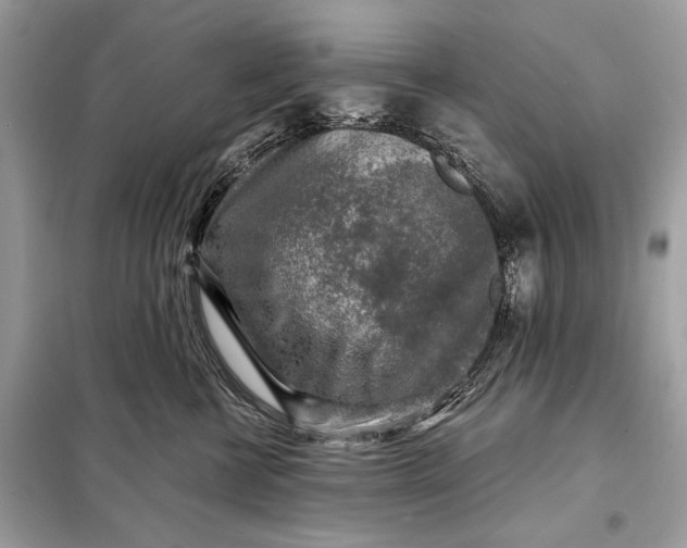 X0000098170570200805081003