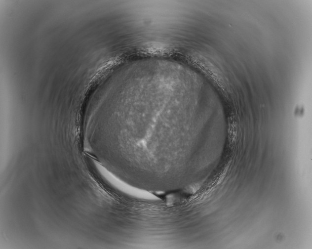 X0000098170593200805081003