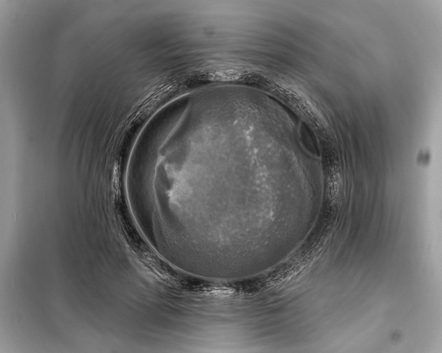 X0000098170598200805081003