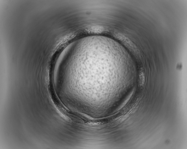 X0000098170638200805081002