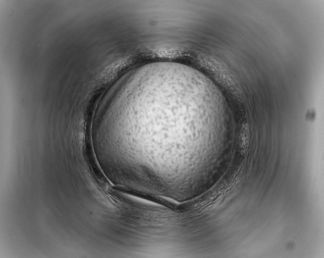 X0000098170639200805081002