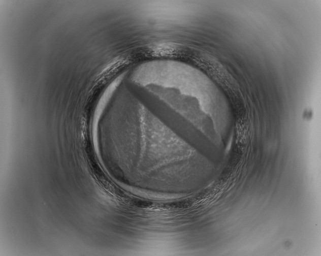 X0000098170648200805081002