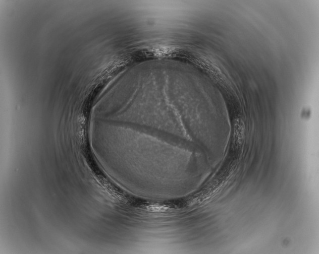 X0000098170650200805081002