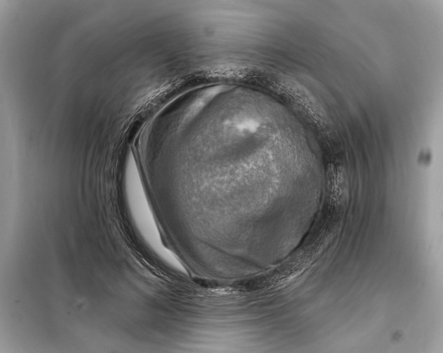 X0000098170692200805081001