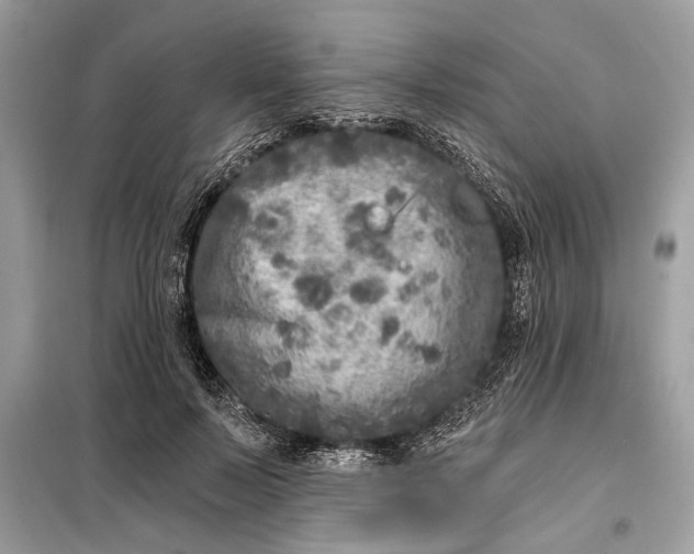 X0000098170695200805081001