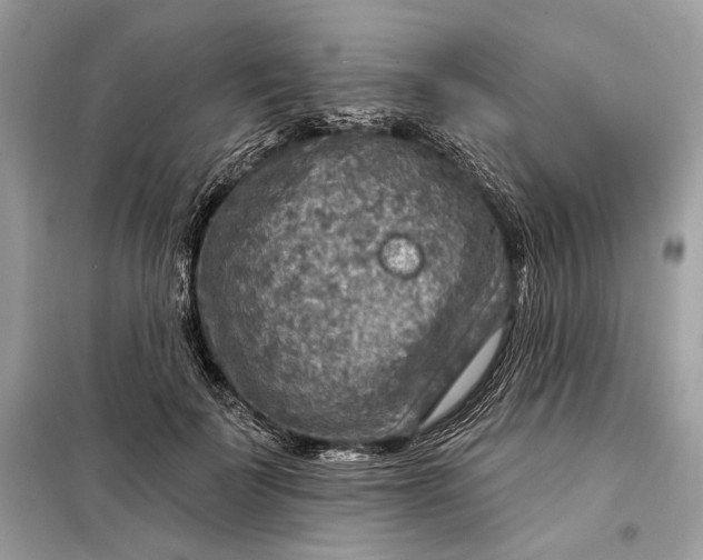 X0000098170699200805081001