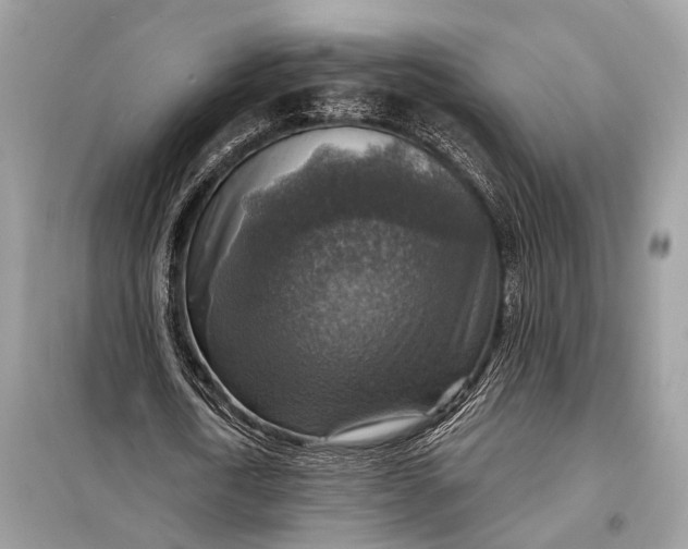 X0000098170722200805081000