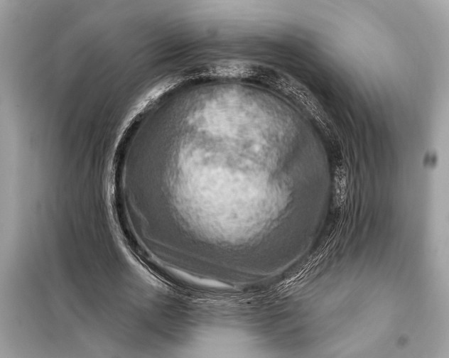 X0000098170726200805081000