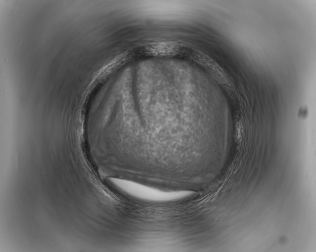 X0000098170733200805081000