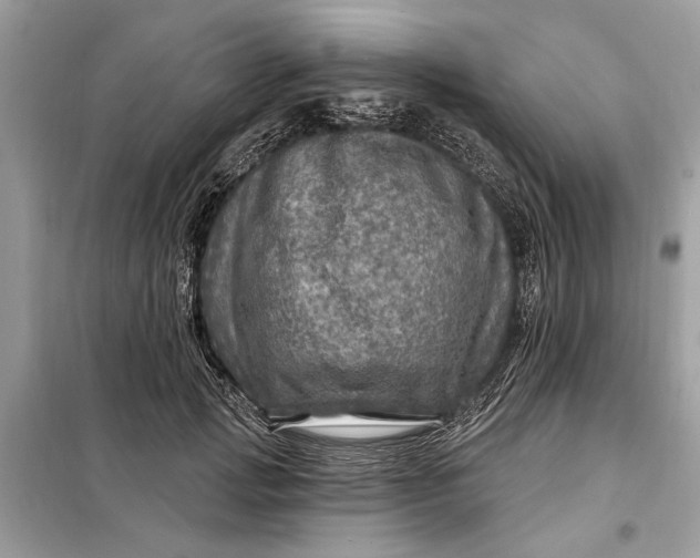 X0000098170749200805081001