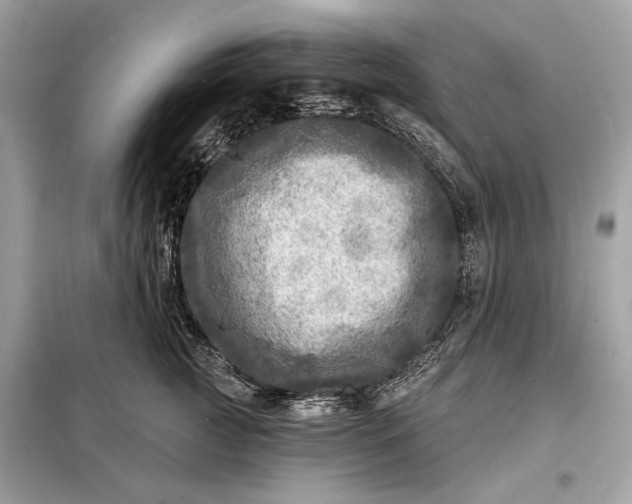 X0000098170761200805081001