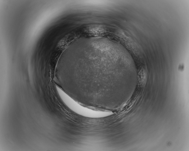 X0000098170762200805081001