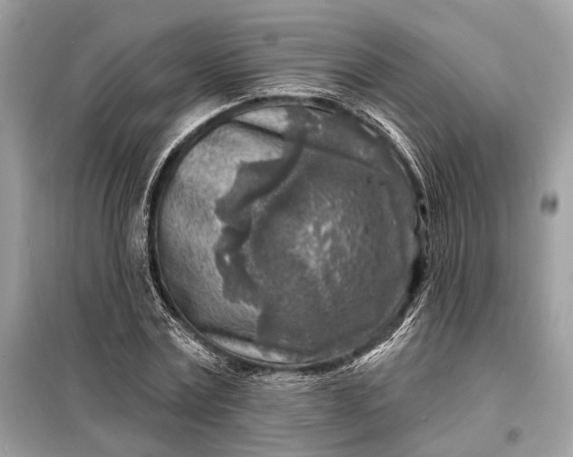 X0000098170779200805081000