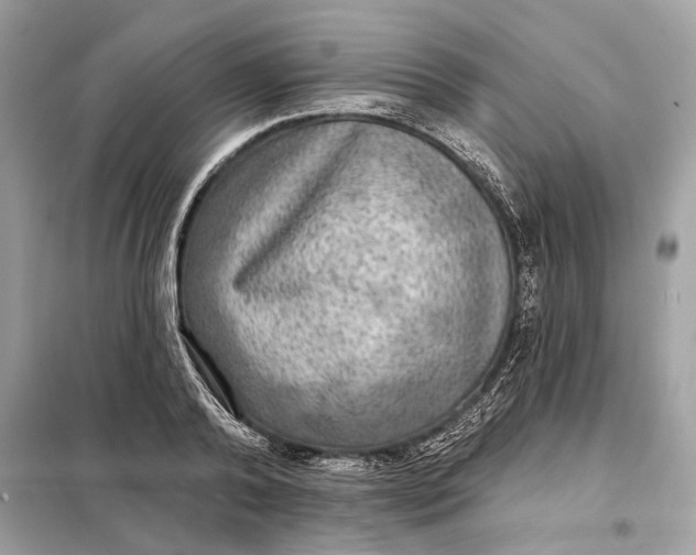 X0000098170792200805081000