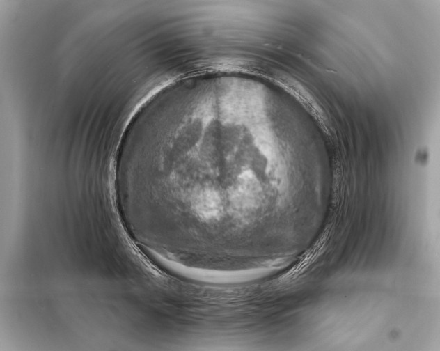 X0000098170798200805081000