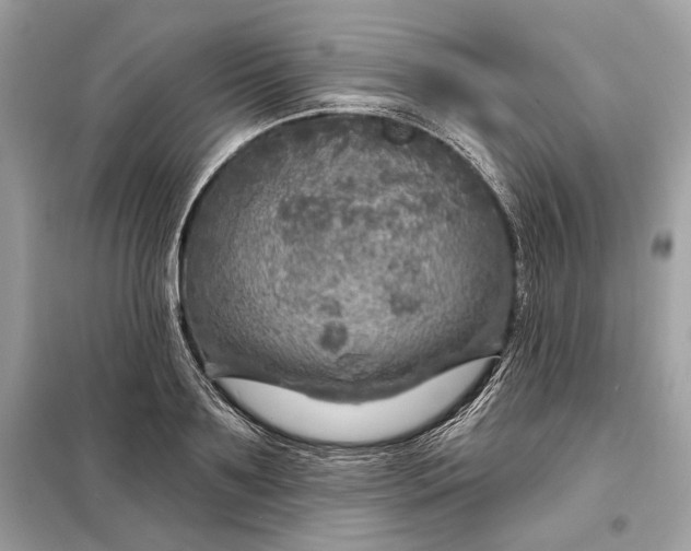 X0000098170891200805080958