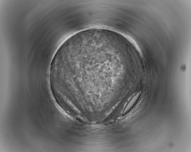 X0000098170903200805080958