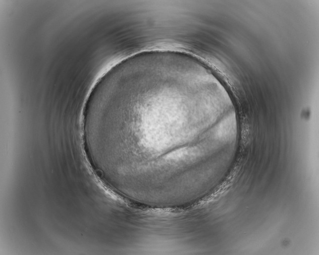 X0000098170990200805080957