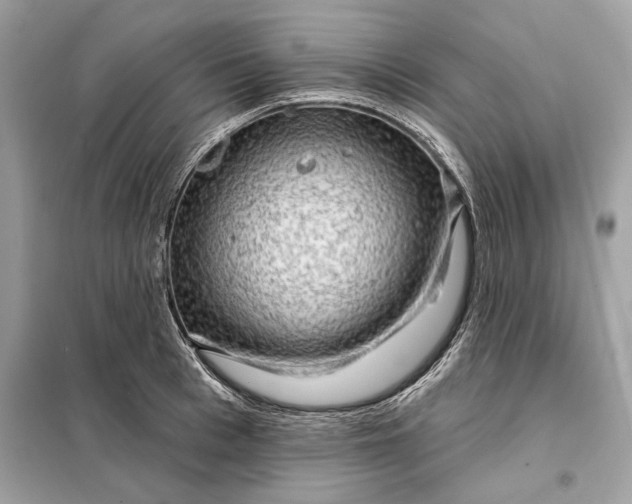 X0000098170993200805080957