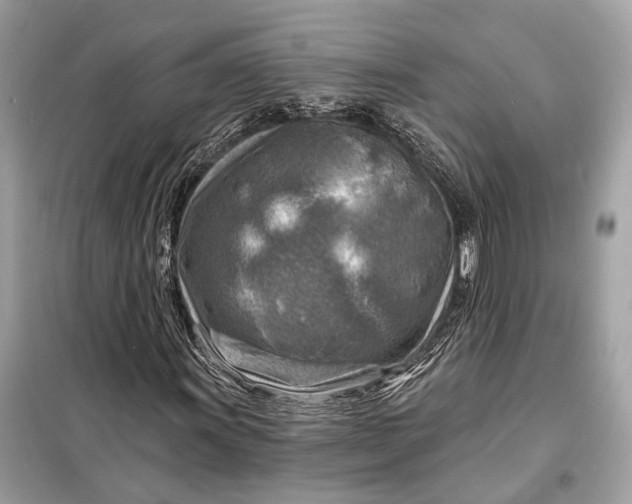 X0000098171011200805080956