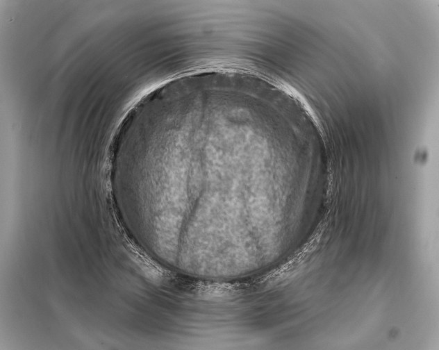 X0000098171019200805080956