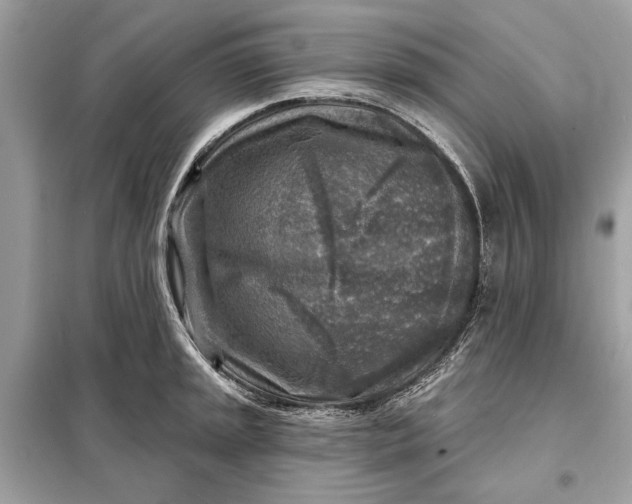 X0000098171045200805080956