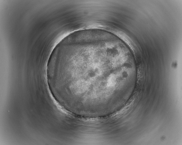 X0000098171047200805080956