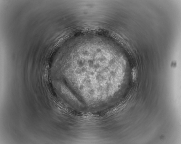 X0000098171059200805080956