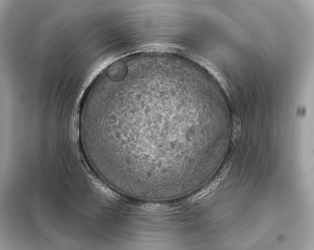 X0000098171075200805080955