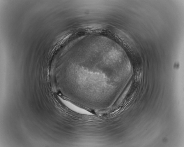 X0000098171108200805080954