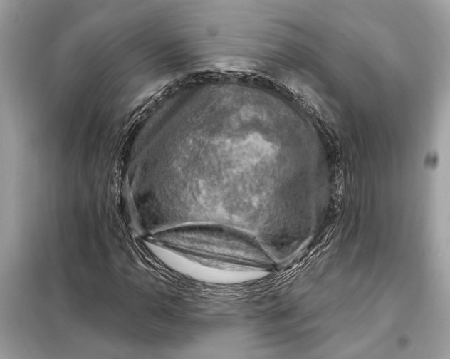 X0000098171110200805080954