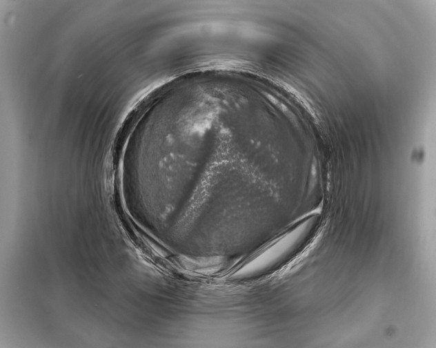 X0000098171117200805080954