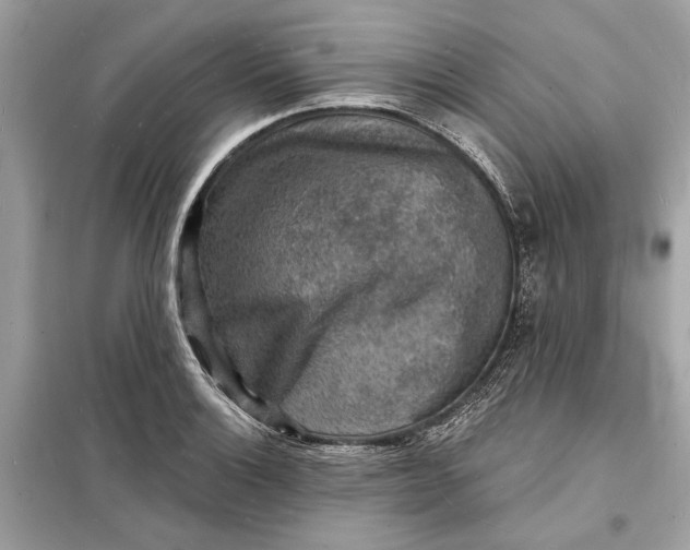 X0000098171132200805080955