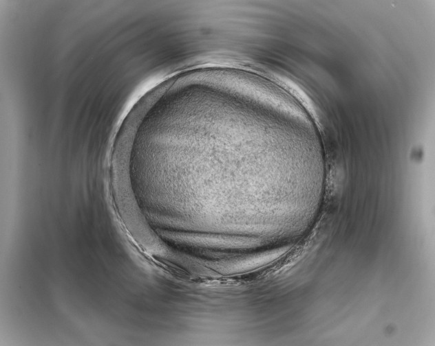 X0000098171146200805080955