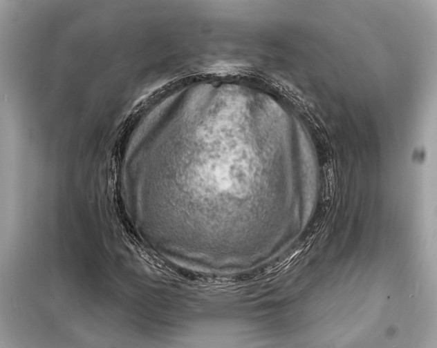 X0000098171158200805080954