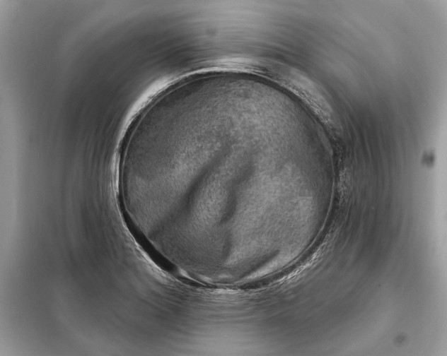 X0000098171180200805080954