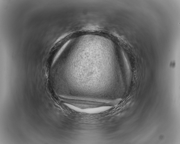 X0000098171206200805080953