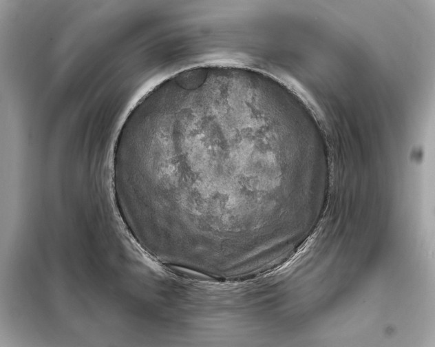 X0000098171240200805080953