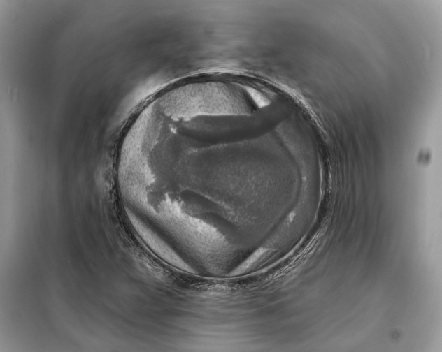 X0000098171359200805080951