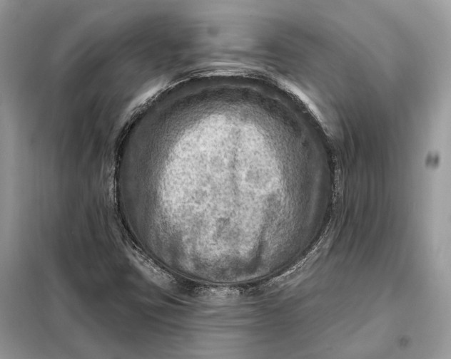 X0000098171403200805080950