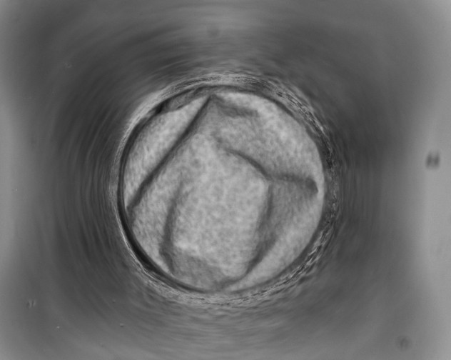 X0000098170003200805151128