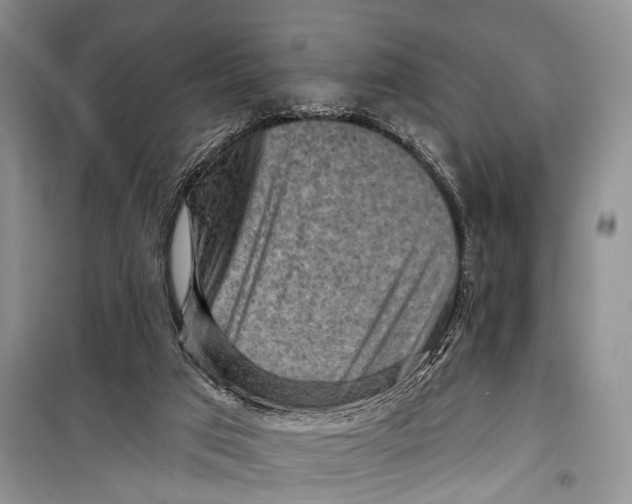 X0000098170017200805151127