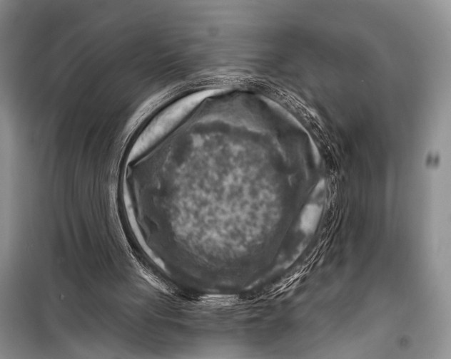 X0000098170051200805151126