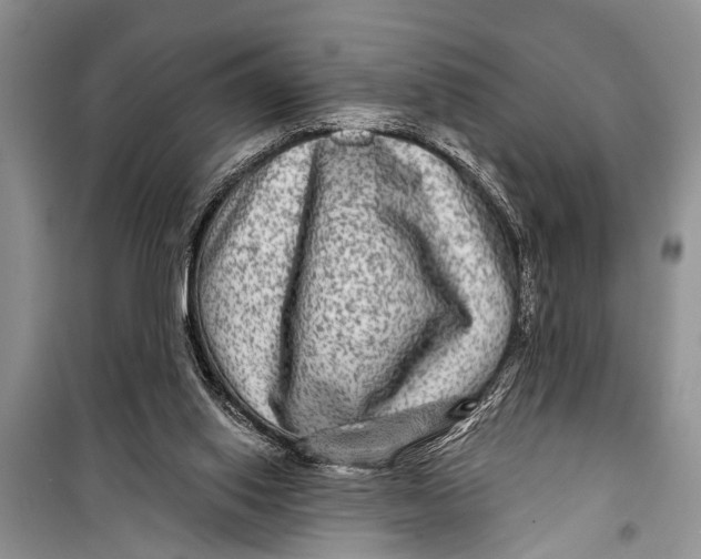 X0000098170062200805151126