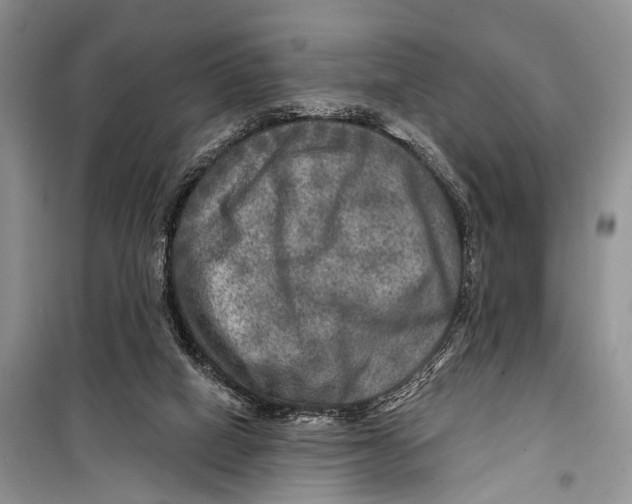 X0000098170066200805151127